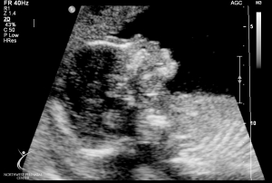 ultrasound 2014-12-10 08.jpg